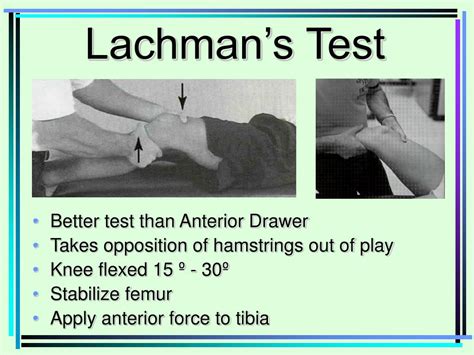 lachman test vs anterior drawer